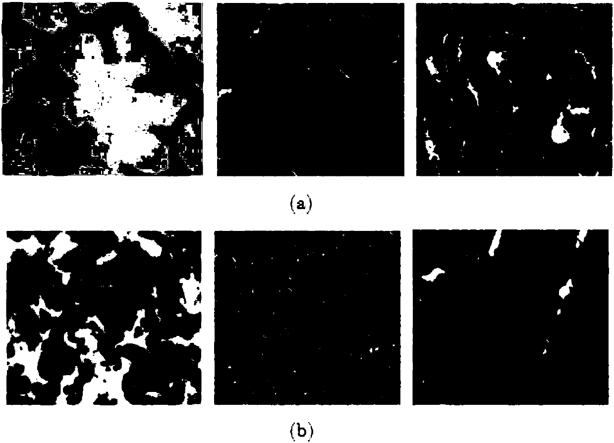 Tissue pathology image recognition method