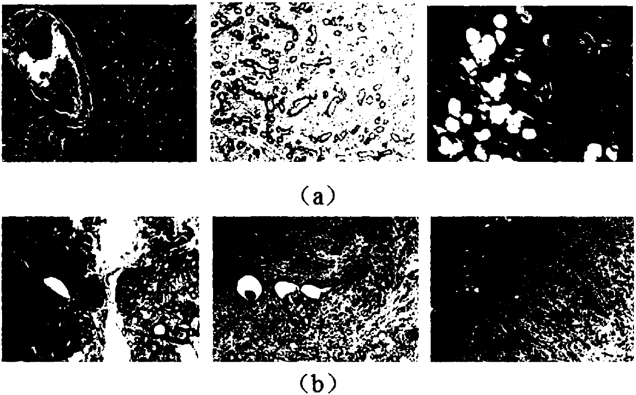 Tissue pathology image recognition method