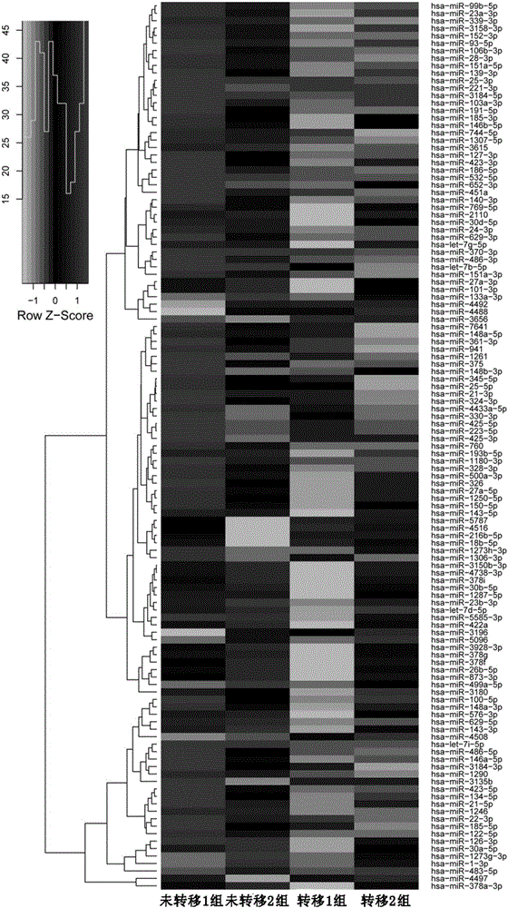 Colorectal cancer metastasis detection primer and kit based on serum exosomal microRNAs