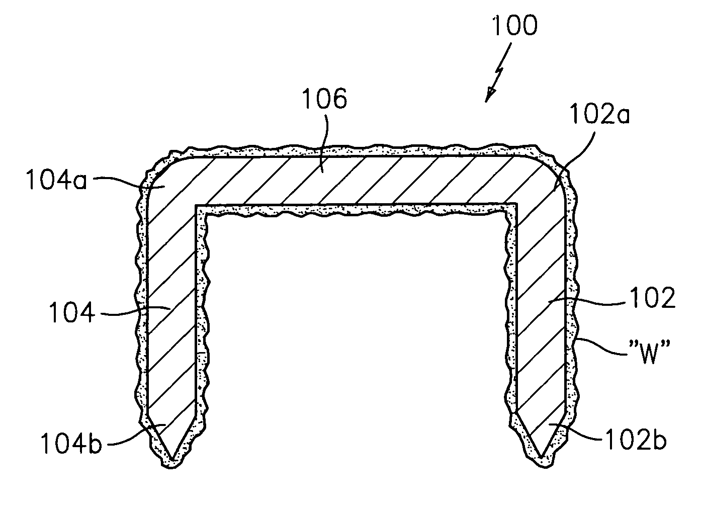 Surgical fasteners coated with wound treatment materials