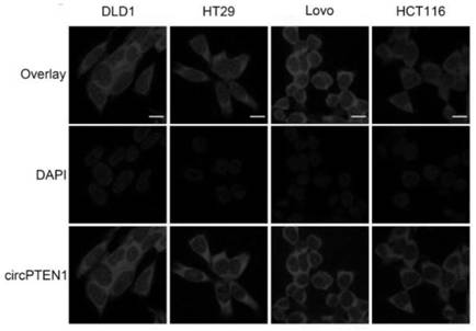 A kind of circpten1 for tumor therapy target and diagnostic biomarker and its application