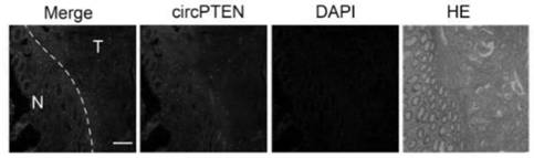 A kind of circpten1 for tumor therapy target and diagnostic biomarker and its application