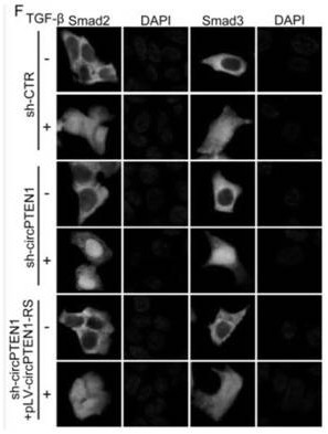 A kind of circpten1 for tumor therapy target and diagnostic biomarker and its application