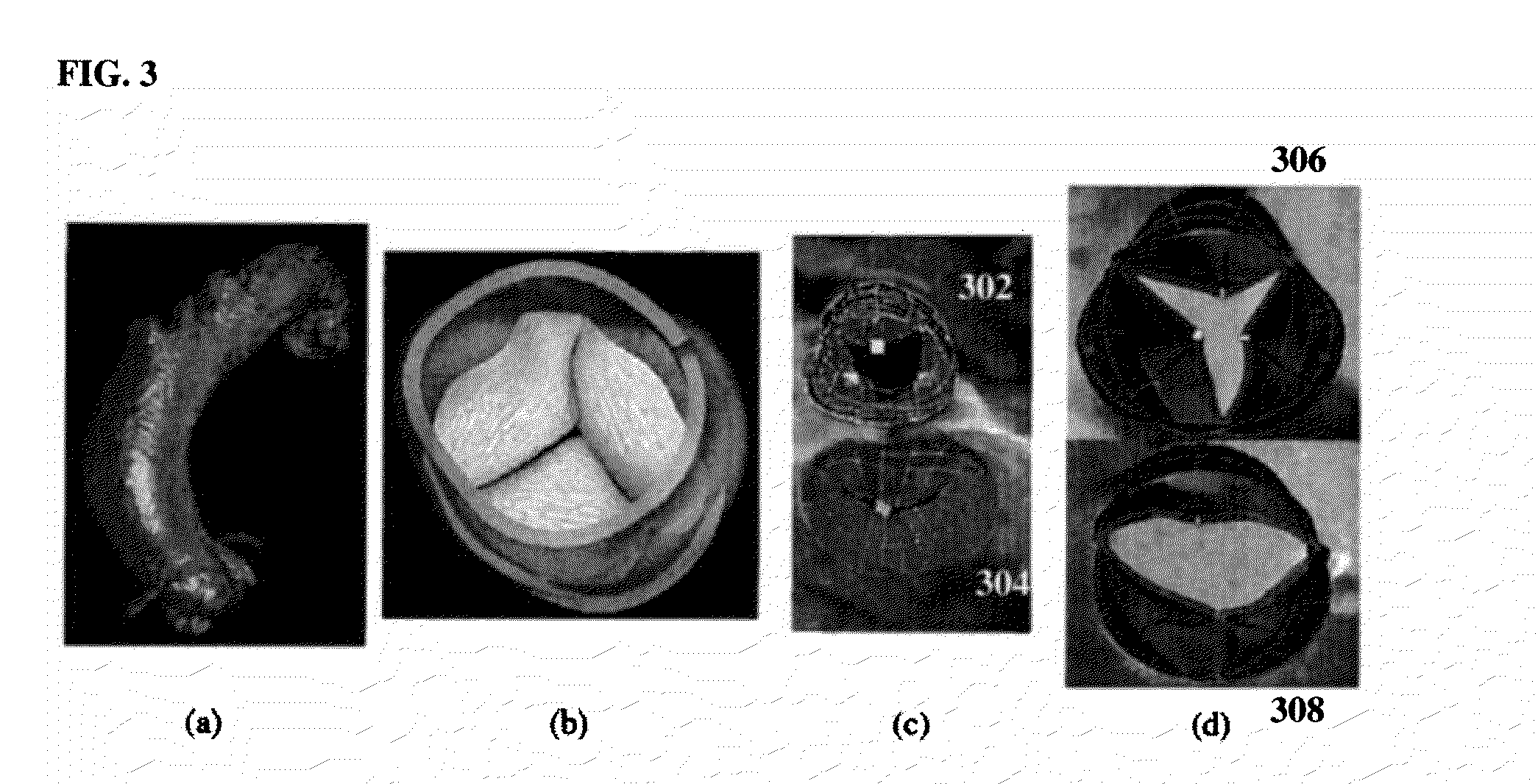 Method and system for computational modeling of the aorta and heart