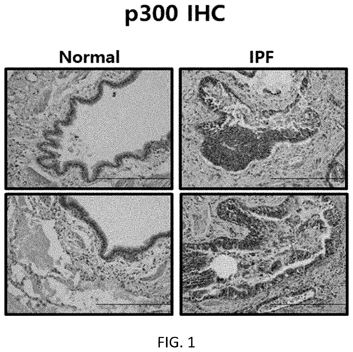 Novel compound for inhibiting histone acetyltransferase p300 and antifibrotic composition comprising same