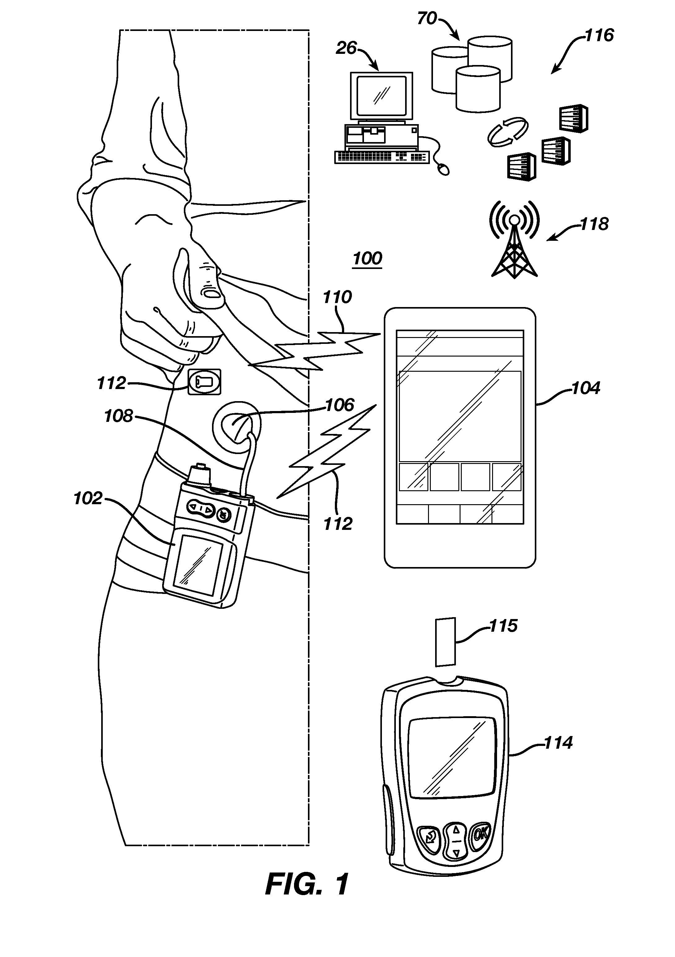 Method and system for management of diabetes with a glucose monitor and infusion pump to provide feedback on bolus dosing