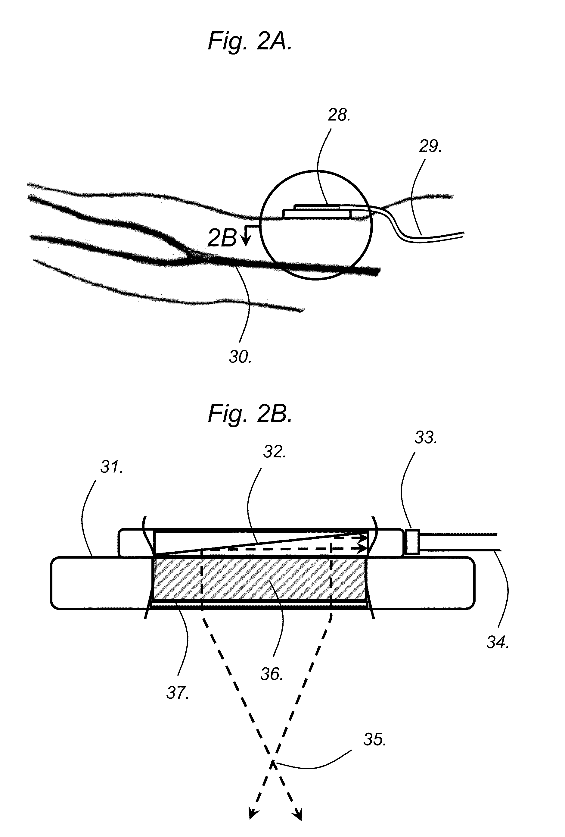 Continuous, non-invasive, optical blood pressure monitoring system