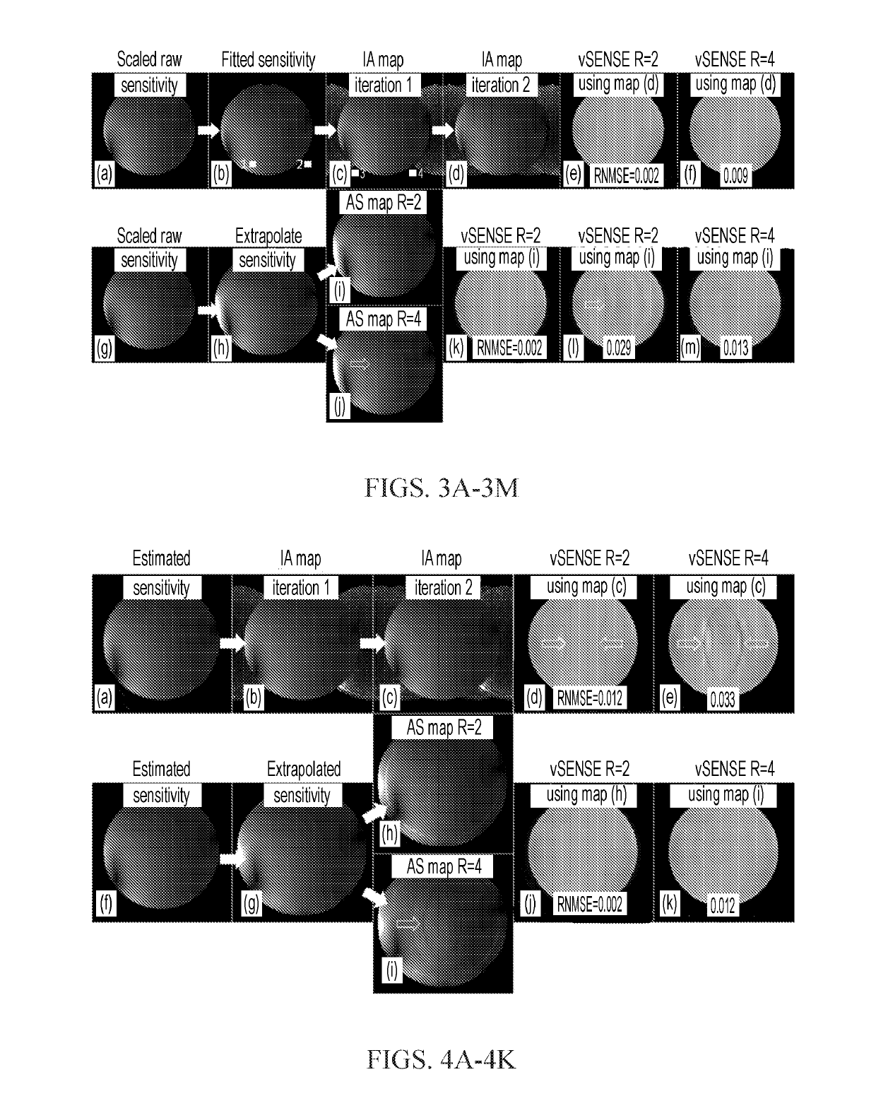 Method of fast imaging of nmr parameters with variably-accelerated sensitivity encoding