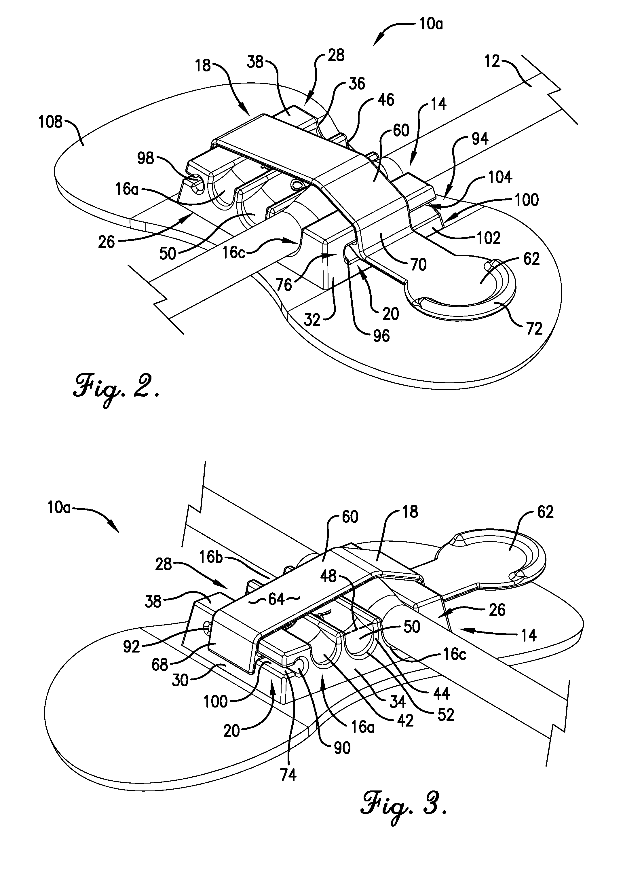 Securement device for medical fixtures