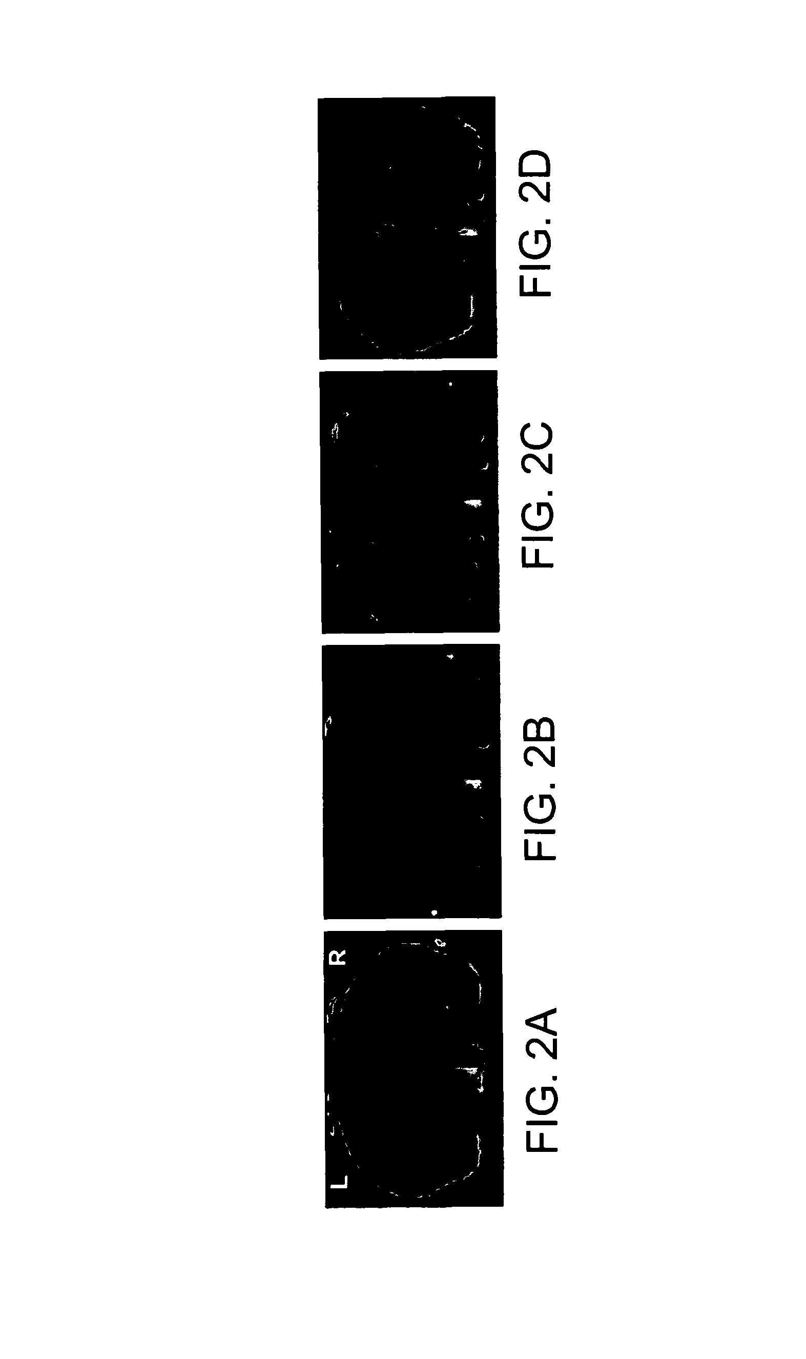 Functionalized magnetic nanoparticles and methods of use thereof