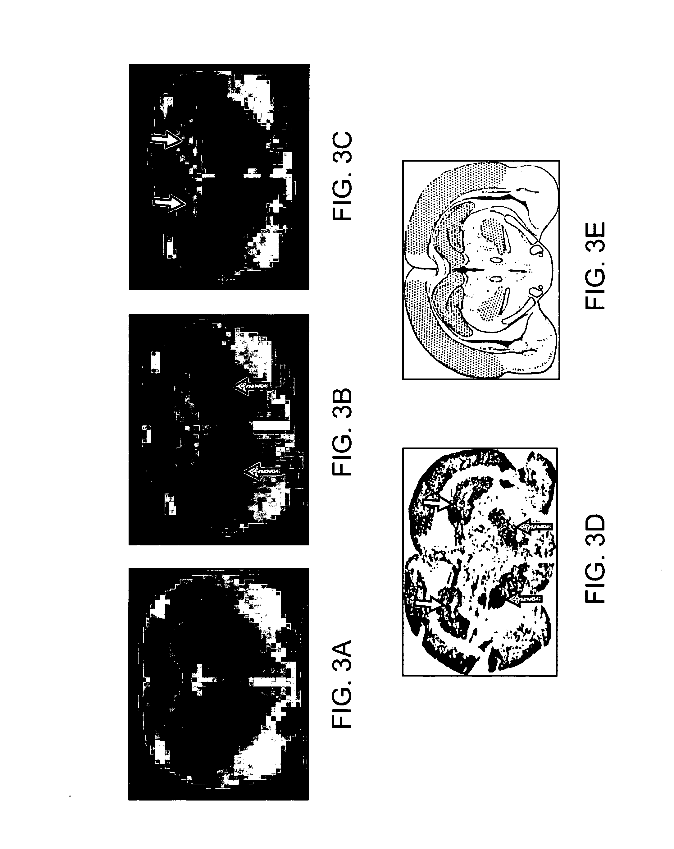 Functionalized magnetic nanoparticles and methods of use thereof