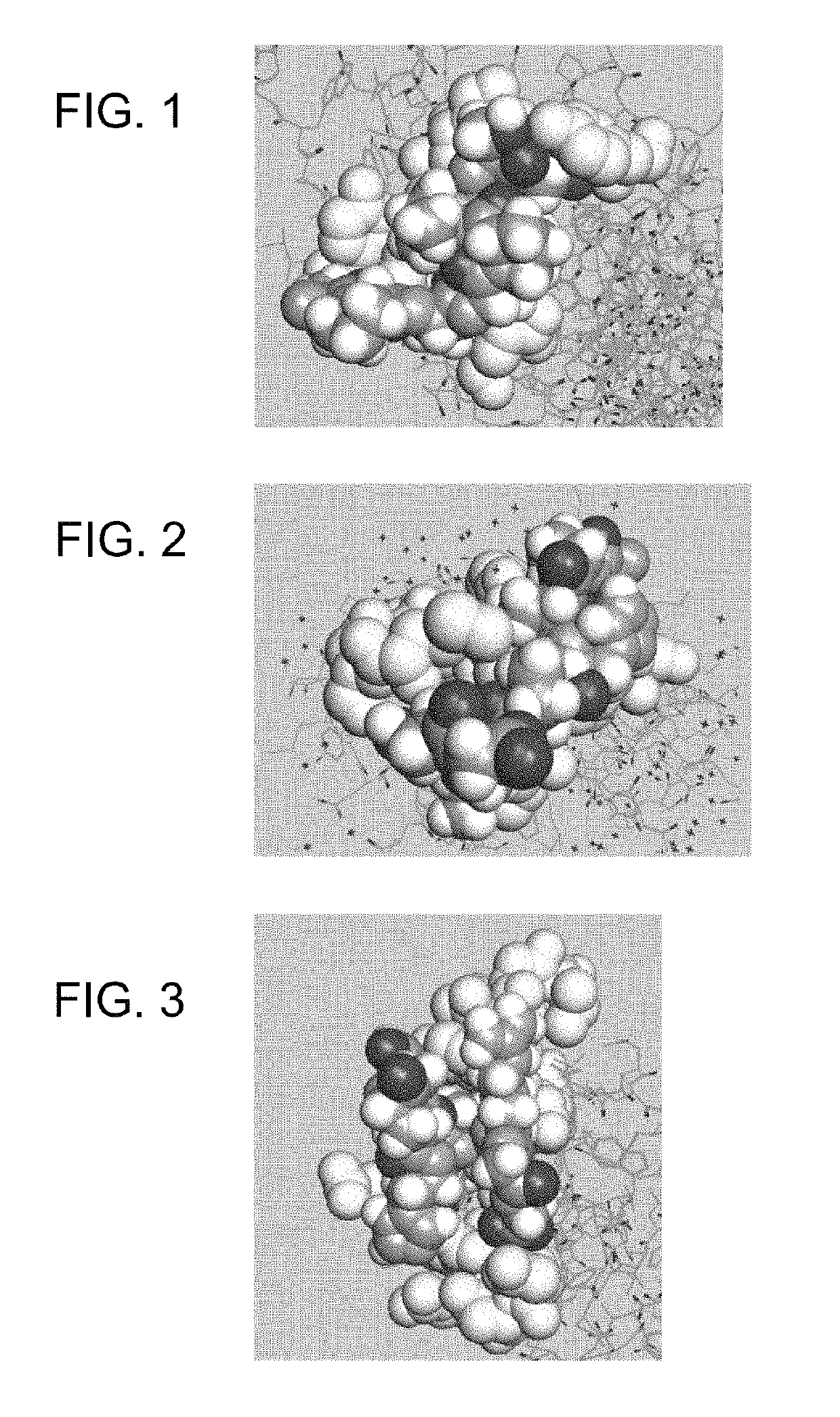 Compositions and methods for treating cancer and persistent viral infections