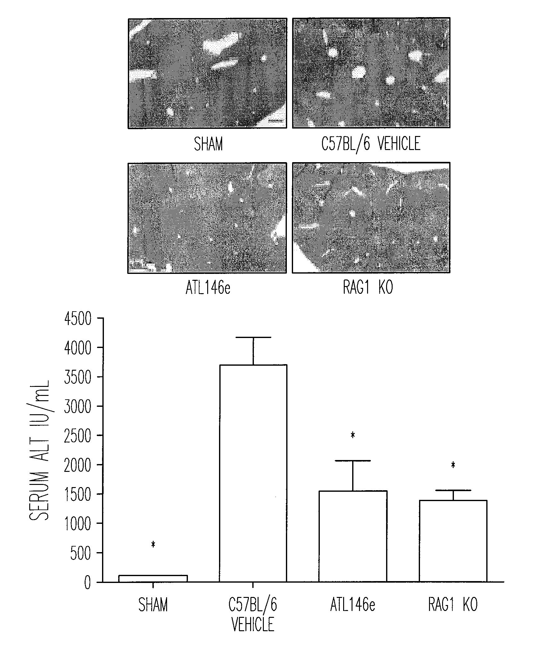 Method of treating ischemia reperfusion injury by inhibing nkt cell activity
