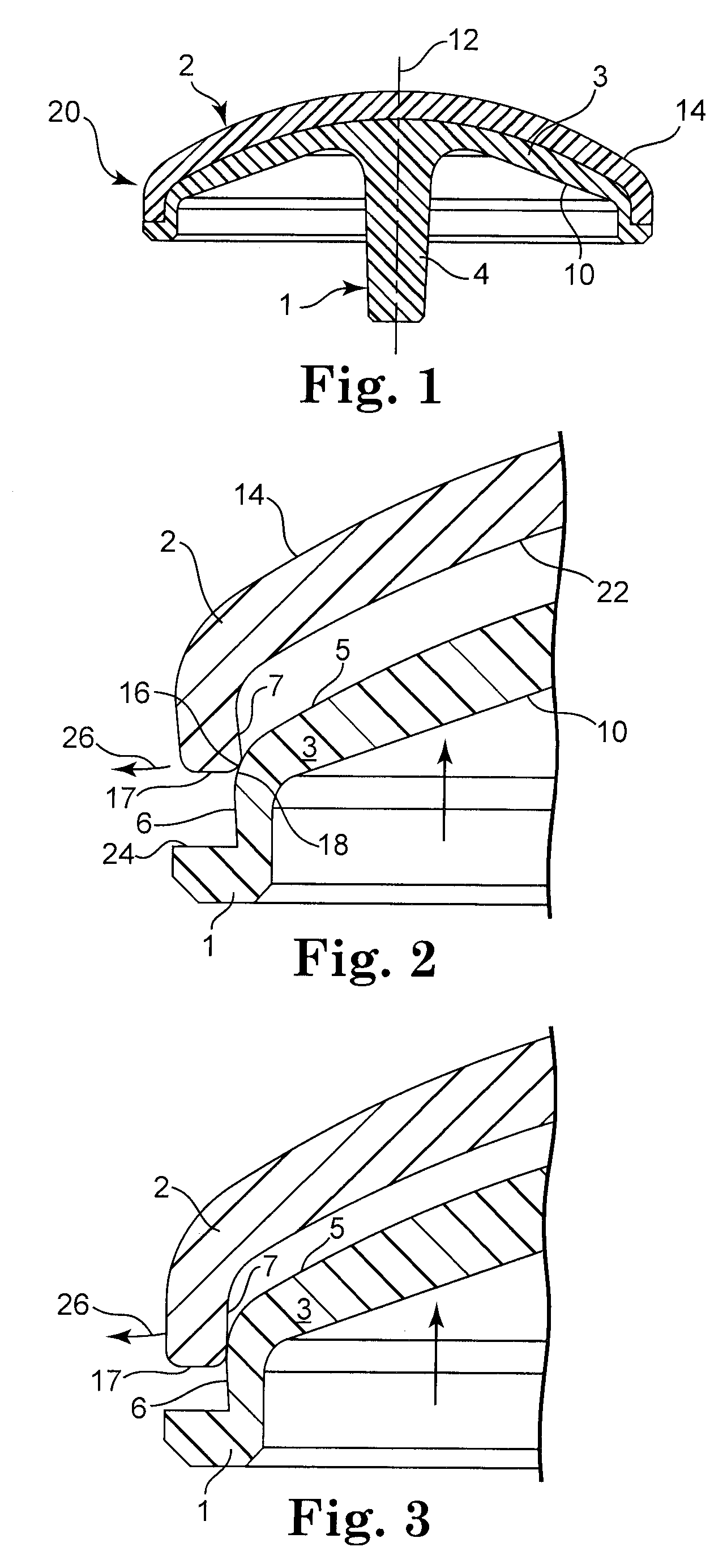 Method and assembly of a pyrolytic carbon component attached to another component