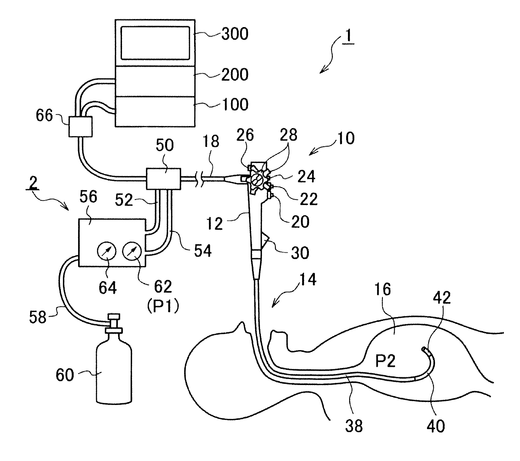 Endoscope air-supply system
