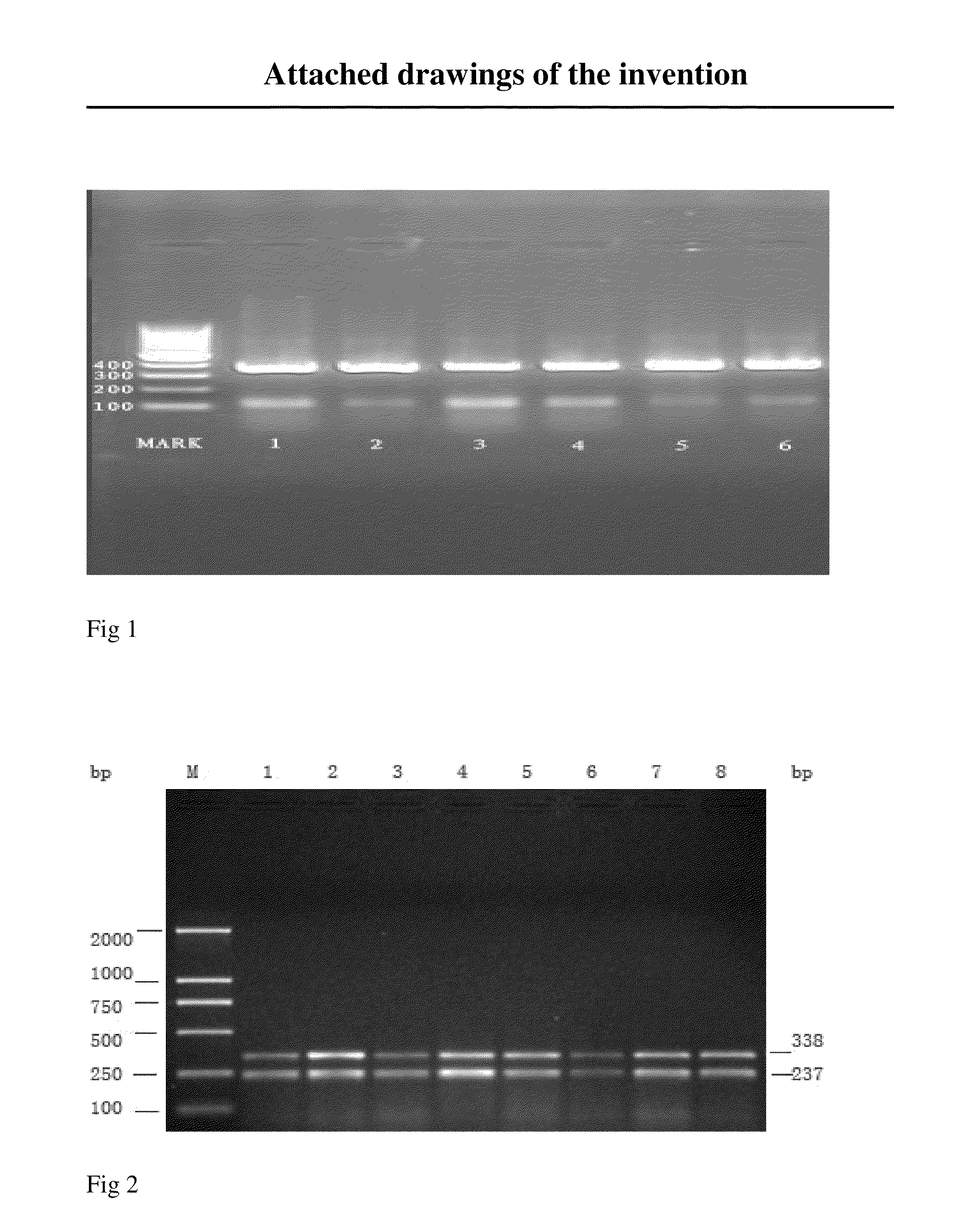 A composition of extracts from plants and the use thereof in prophylaxis or treatment of metabolism disorder of blood lipid