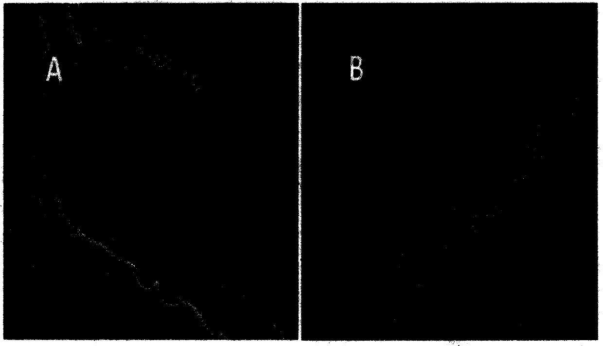 an al  <sub>2</sub> o  <sub>3</sub> -ce  <sub>2</sub> o  <sub>3</sub> /sba-15 mesoporous silicon-based material and preparation method thereof