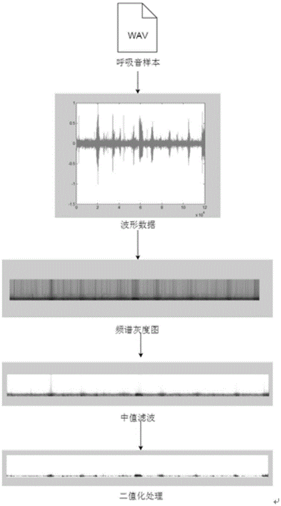 Rhonchus identification method based on frequency domain image processing