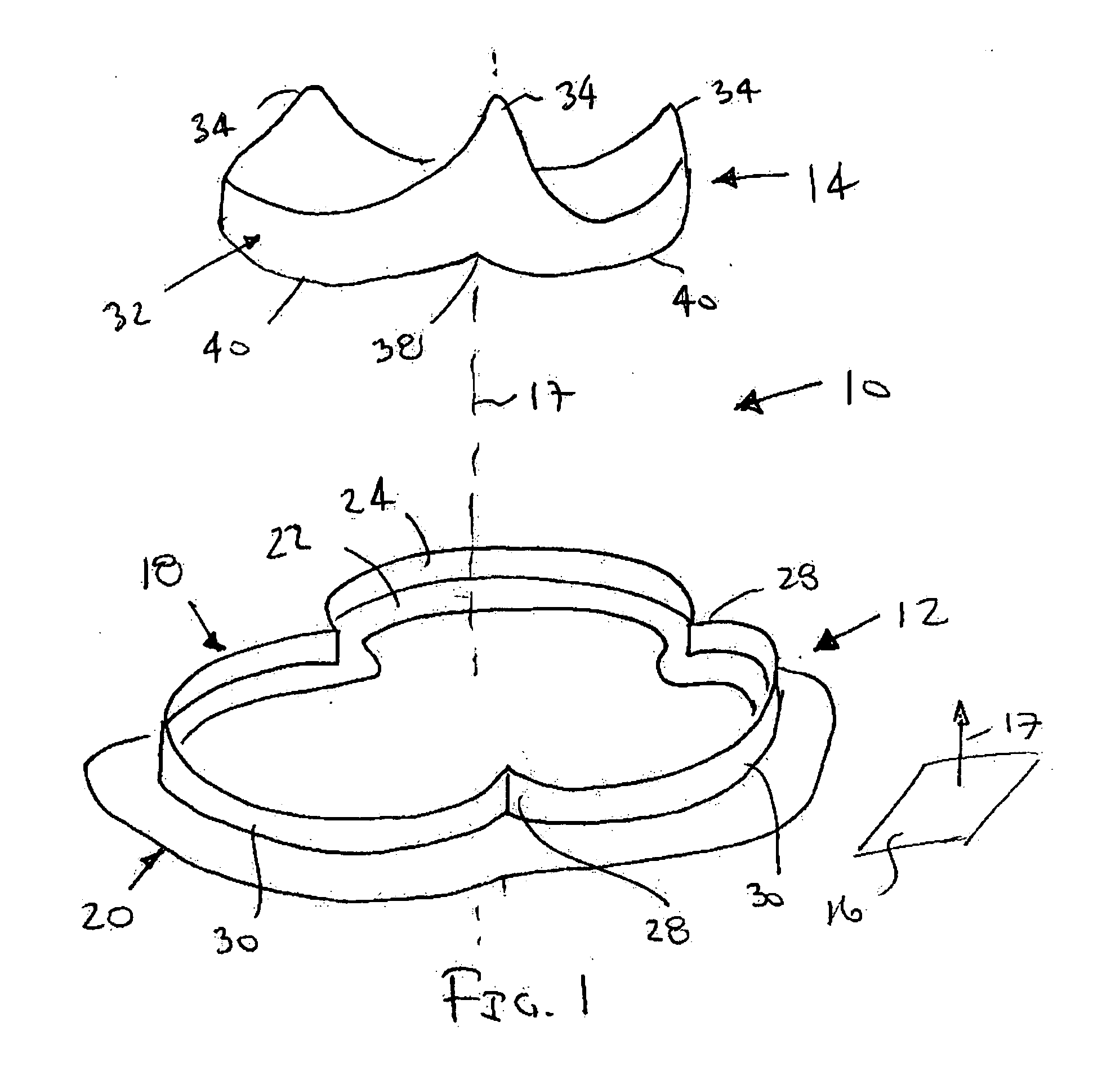 Conformable prosthesis for implanting two-piece heart valves and methods for using them