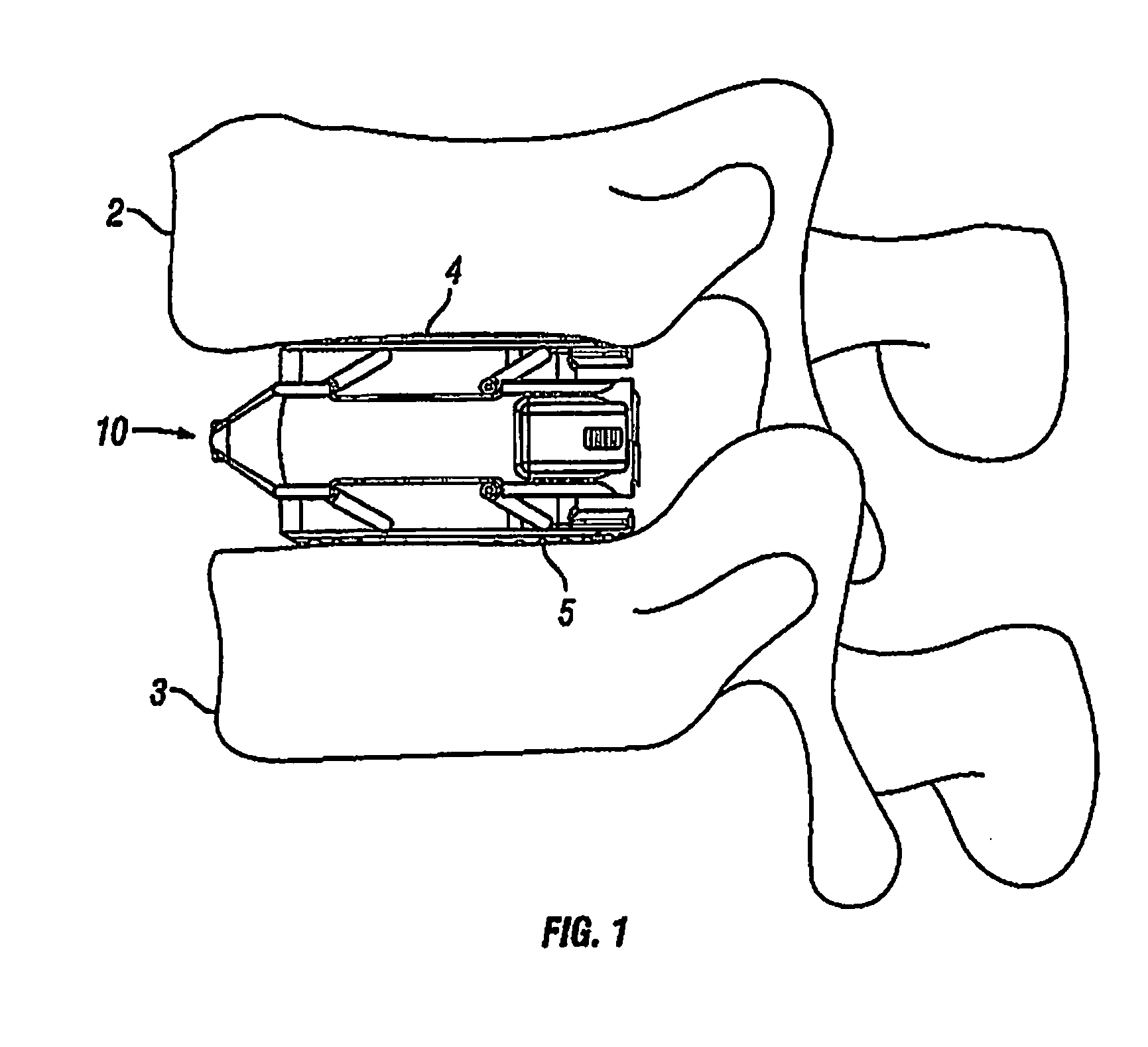 Expandable Fusion Device and Method Installation Thereof