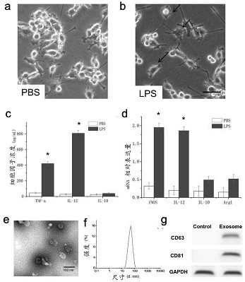 Tumor combined treatment preparation with cell exosome loaded excitation reagent and photosensitizer and application thereof