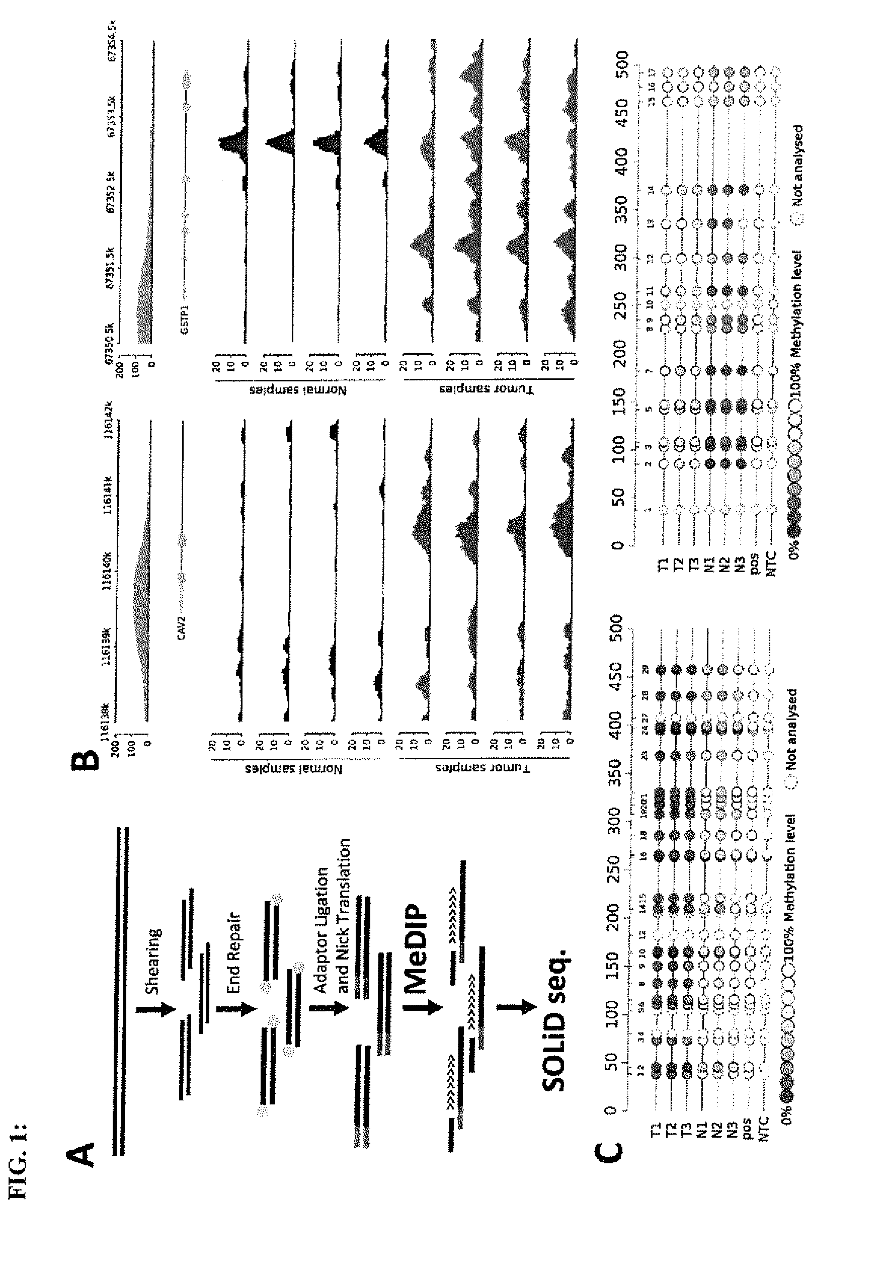 Prostate cancer markers