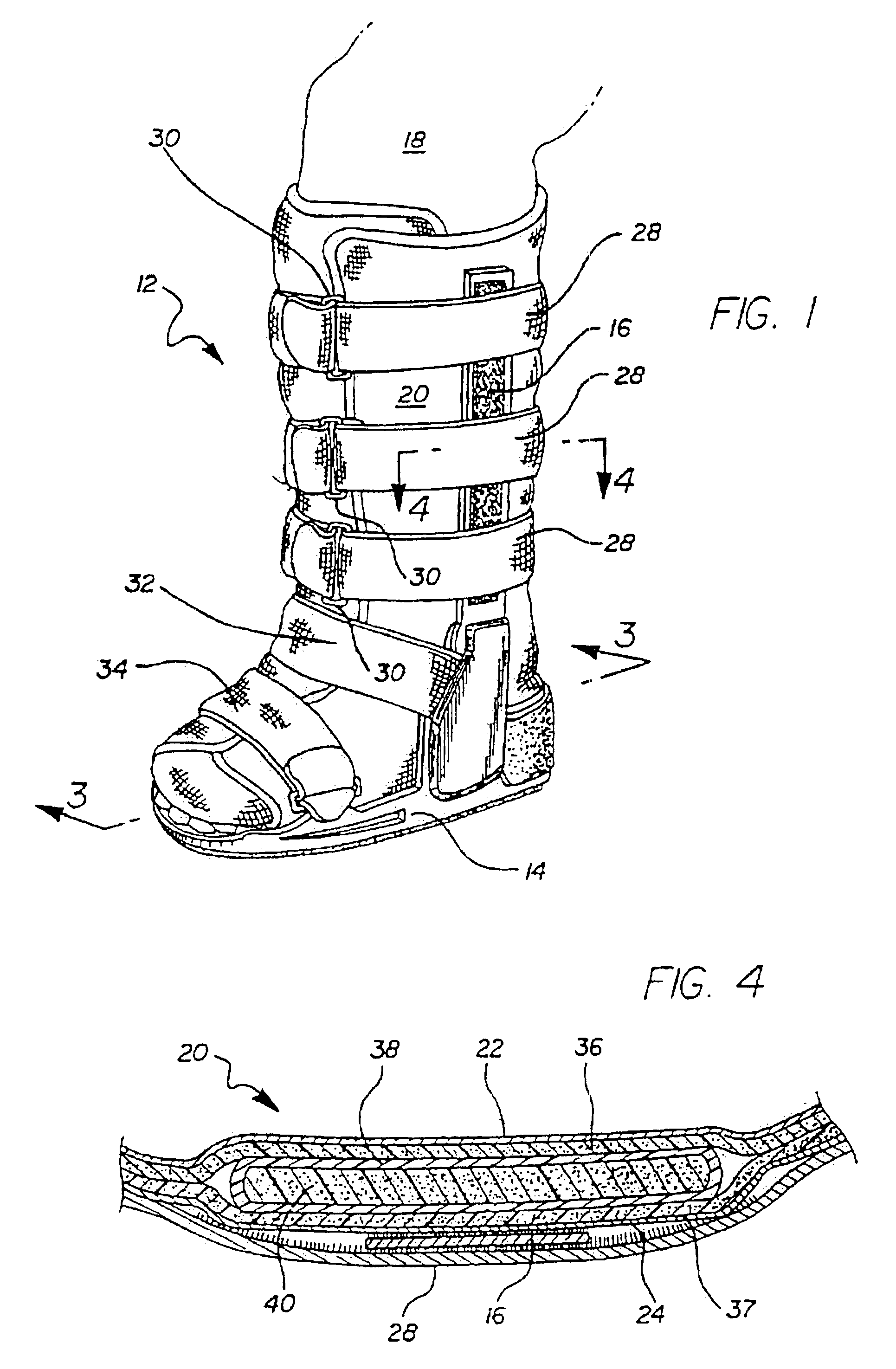 Footgear with pressure relief zones