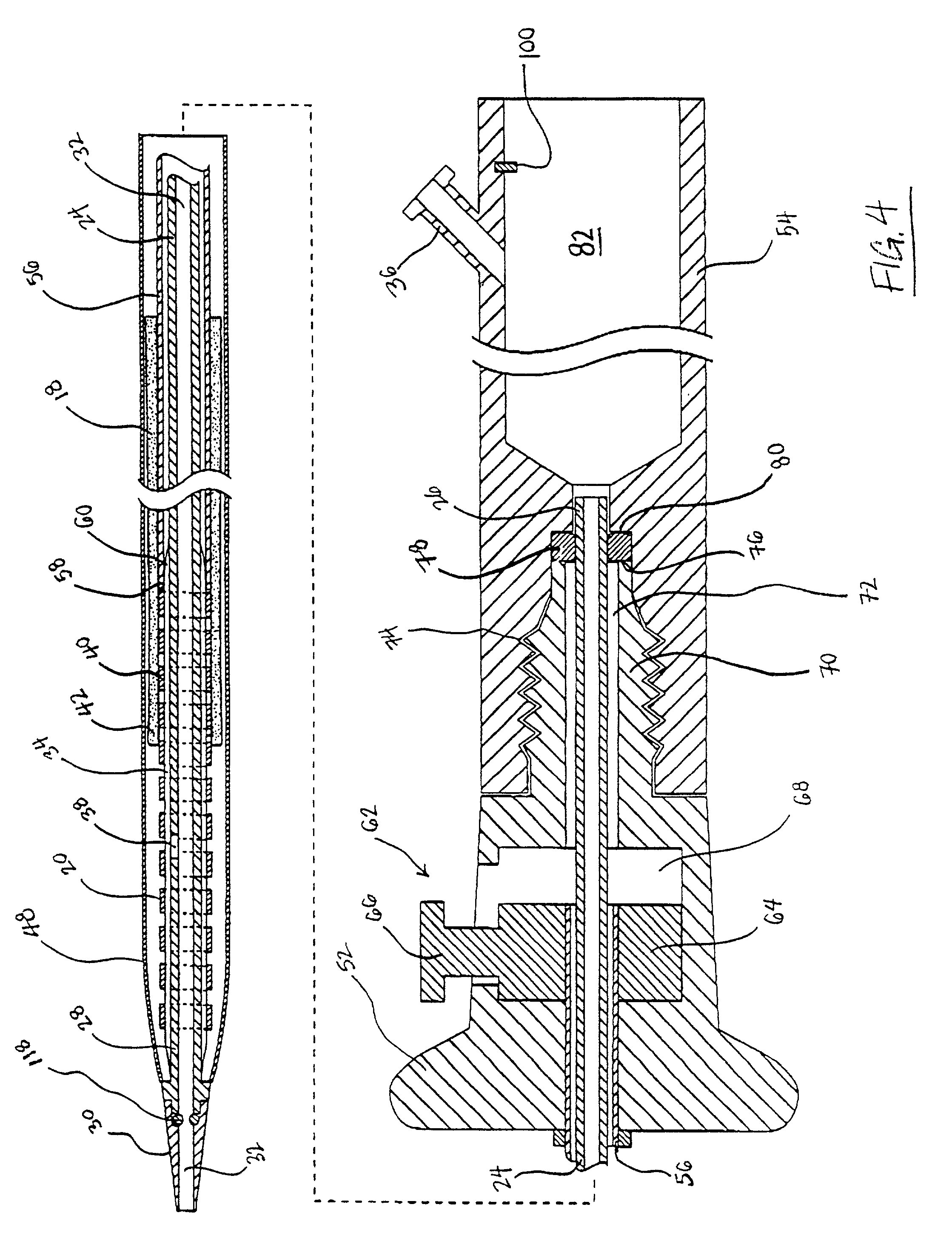 Methods and devices for forming vascular anastomoses