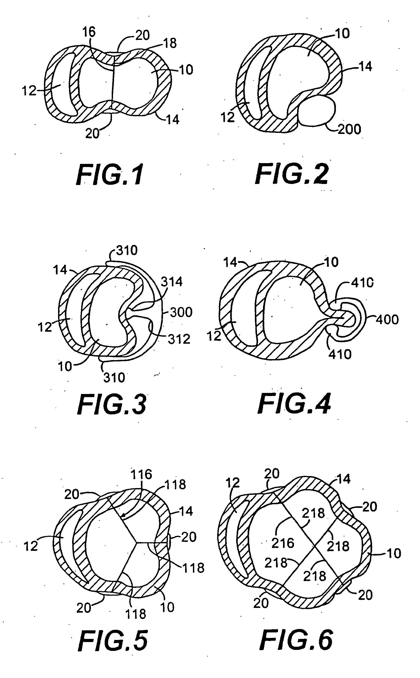 Methods and devices for improving cardiac function in hearts