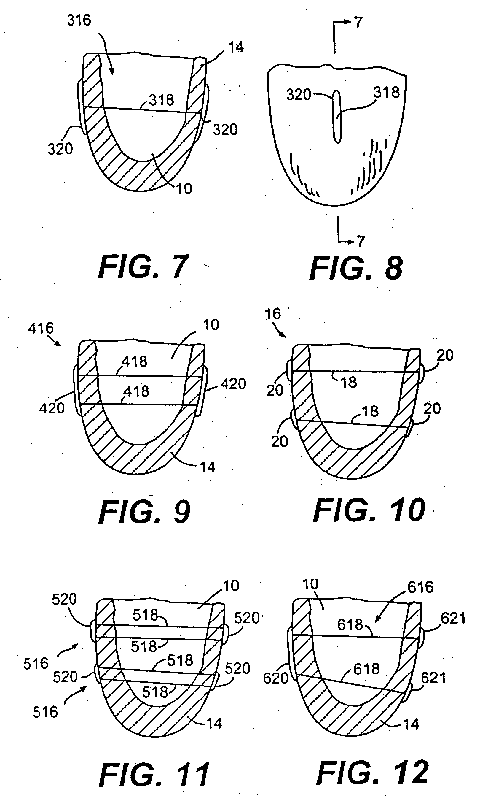 Methods and devices for improving cardiac function in hearts