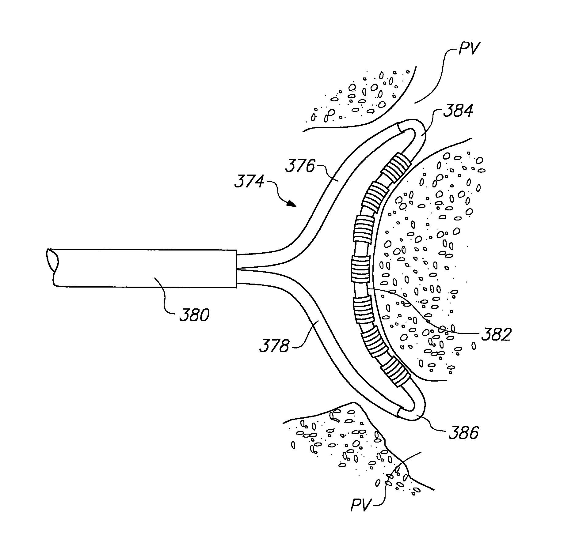 Structures for supporting multiple electrode elements