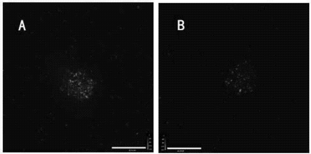 Neural stem cells traced by fluorescence and SPECT/CT double-image functional microspheres and application