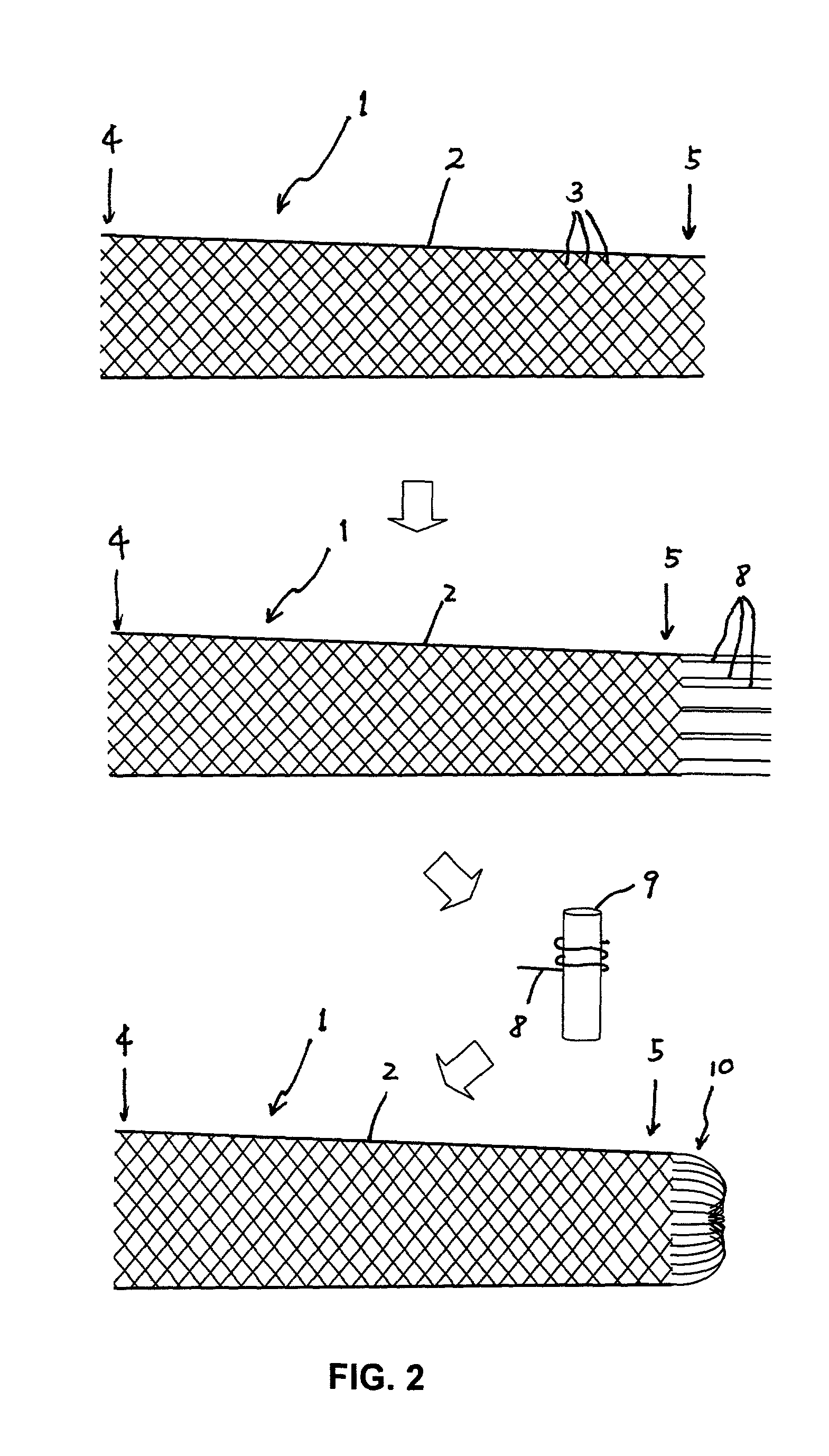 Medical stent with a valve and related methods of manufacturing