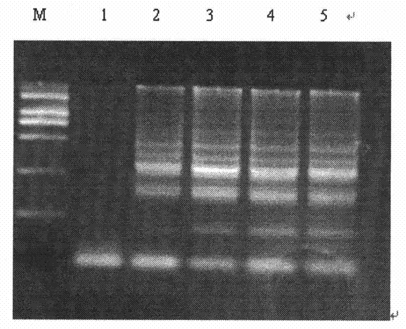 Porcine reproductive and respiratory syndrome virus RT-LAMP detection kit and detection method thereof