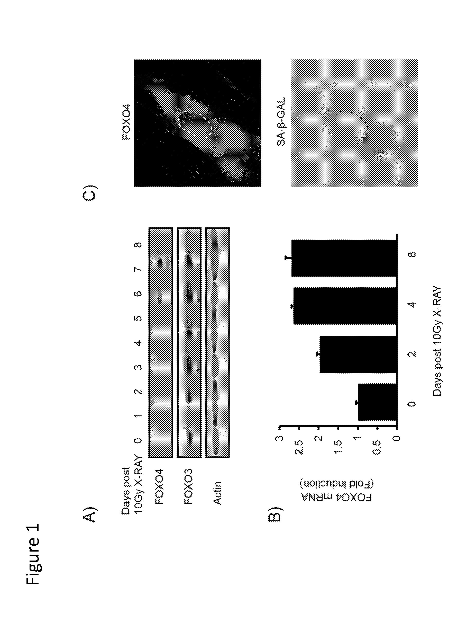 Targeting senescent and cancer cells for selective killing by interference with foxo4