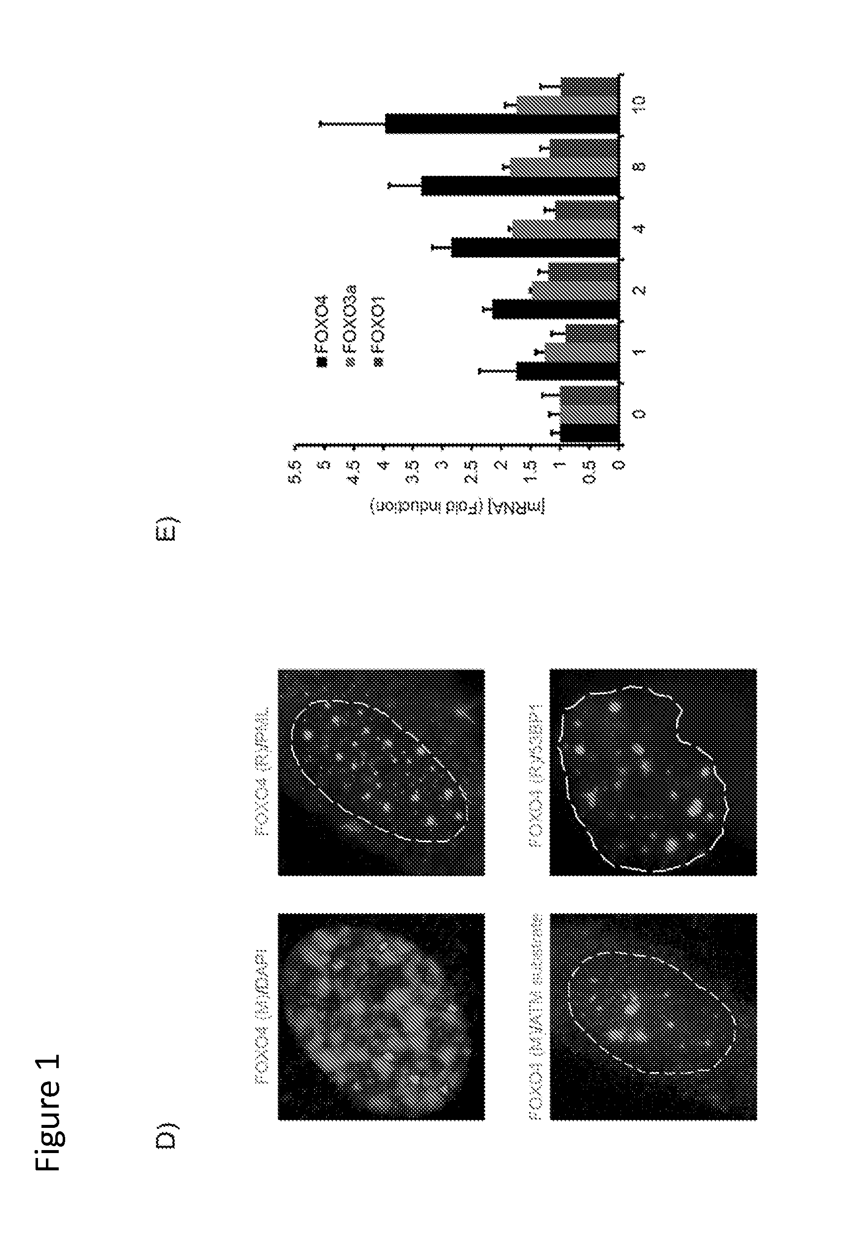 Targeting senescent and cancer cells for selective killing by interference with foxo4