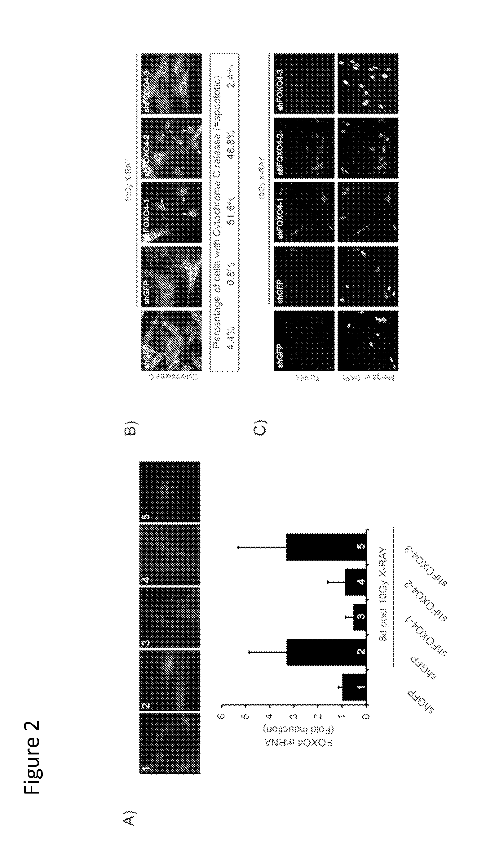 Targeting senescent and cancer cells for selective killing by interference with foxo4