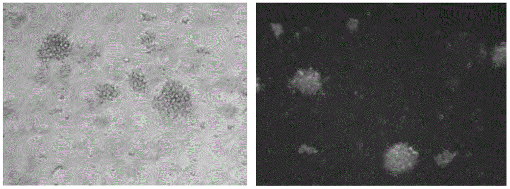 DC cell based on HER-2/NEU antigen, targeting immune cell population, preparation method and applications thereof