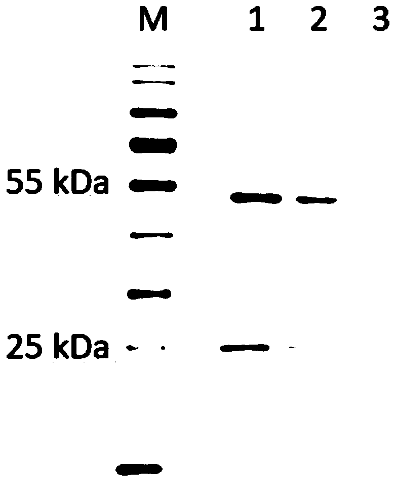 Anti-REG gamma C terminal region monoclonal antibody and preparation and application thereof