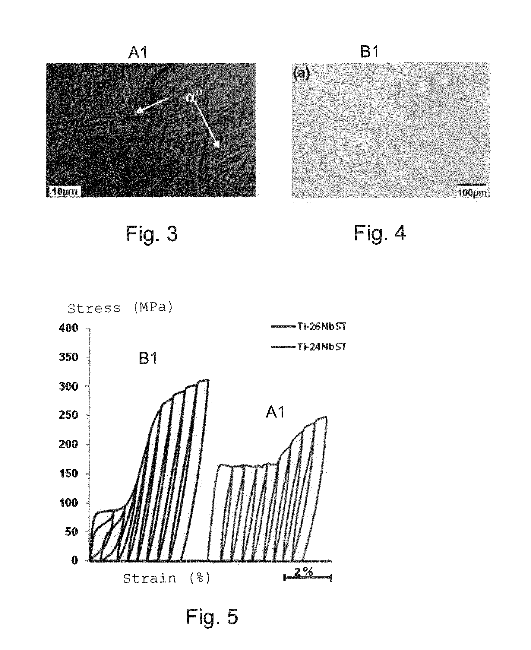 Method for the thermomechanical treatment of a titanium alloy, and resulting alloy and prosthesis