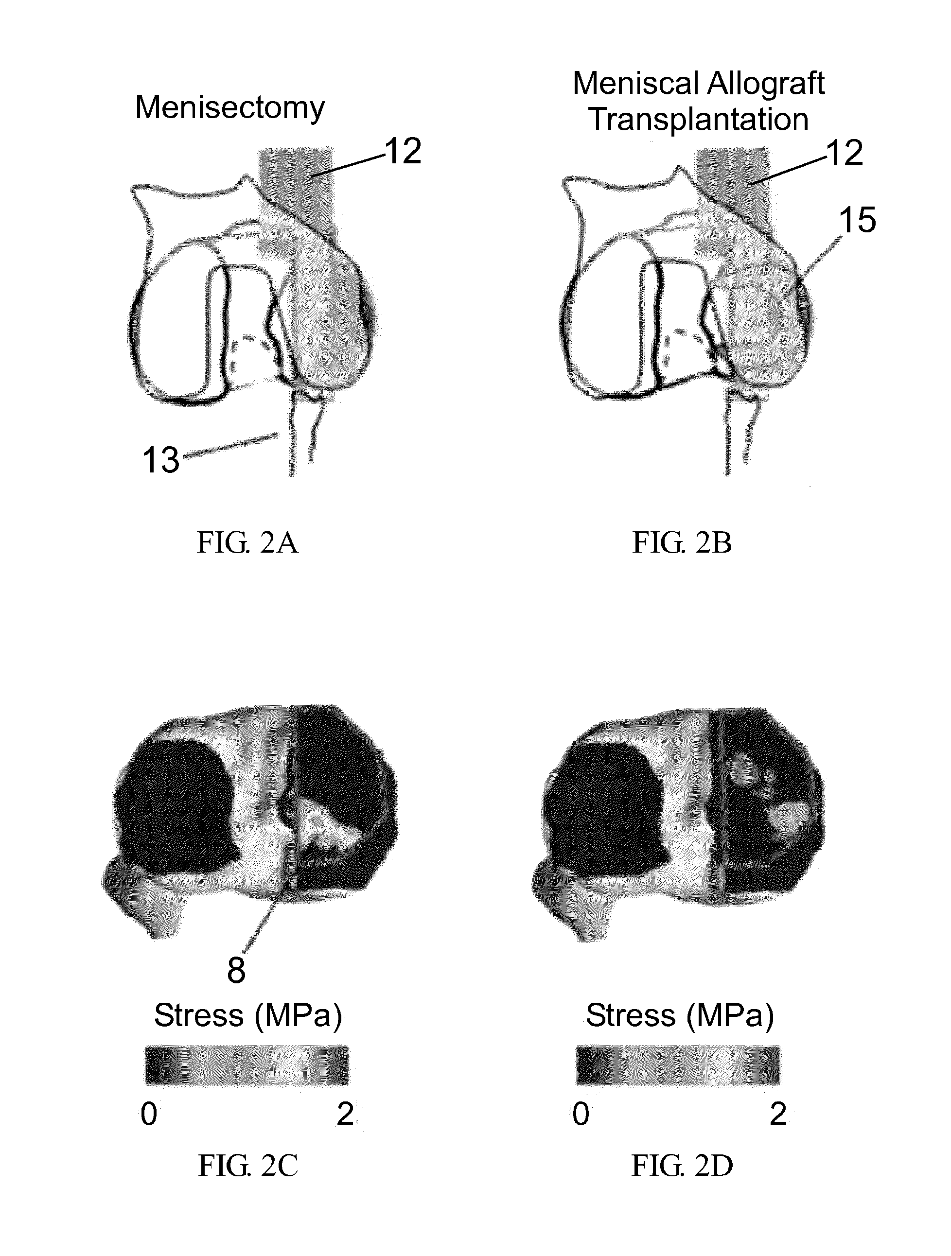 System and method for intraoperative joint contact mechanics measurement