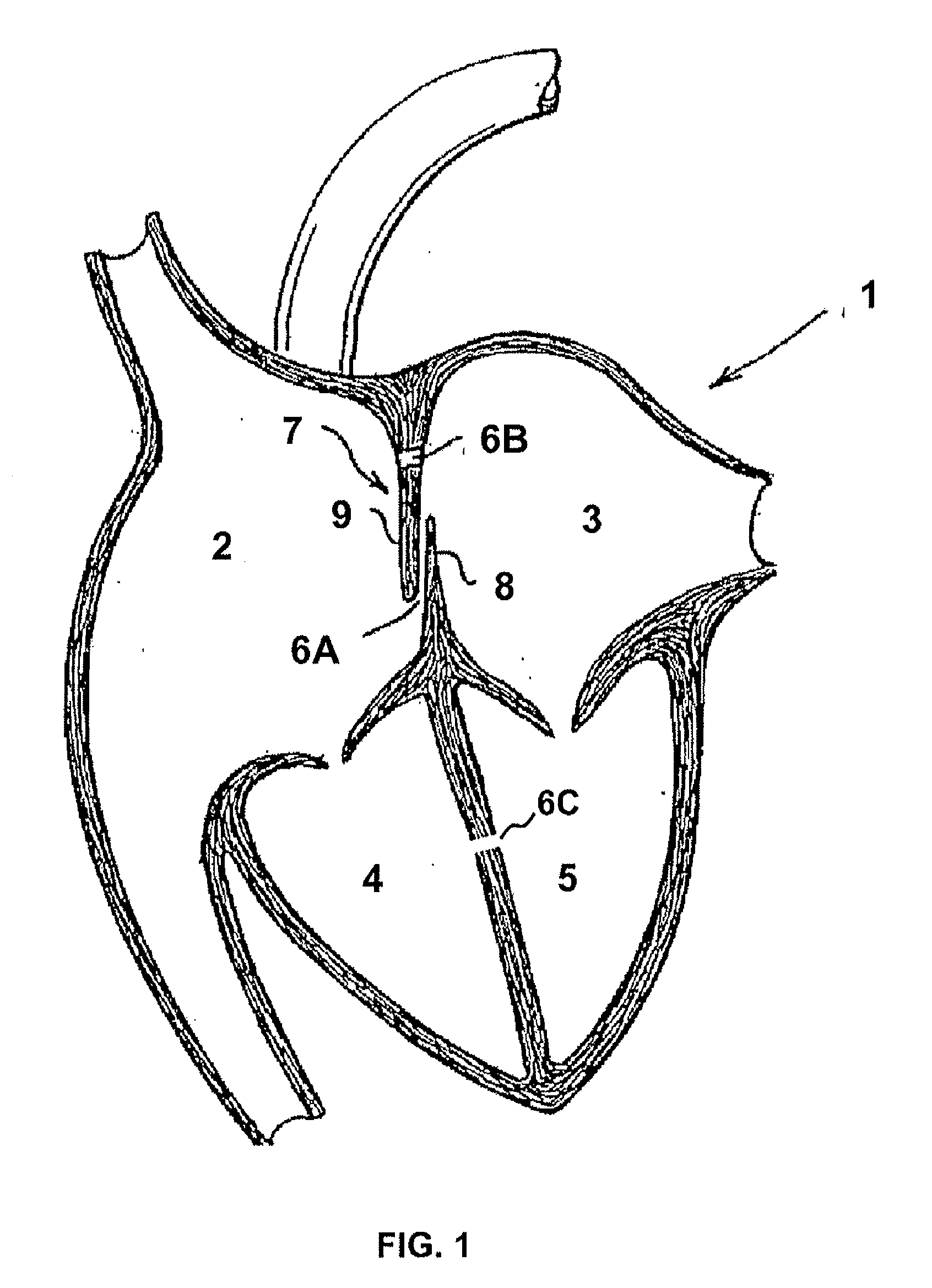 Heart occlusion devices