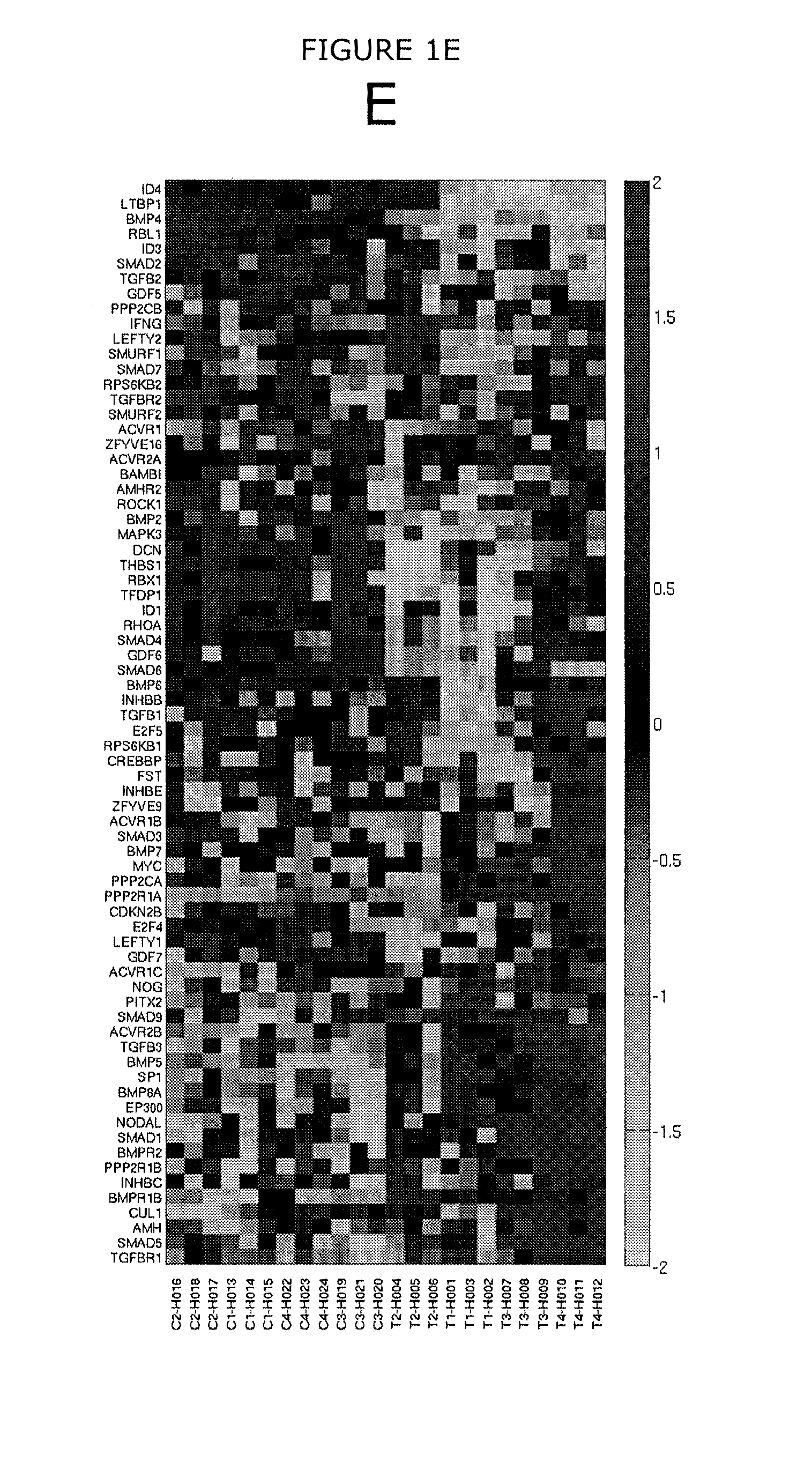 Methods for managing care of patients predisposed to progressive mitral valve diseases