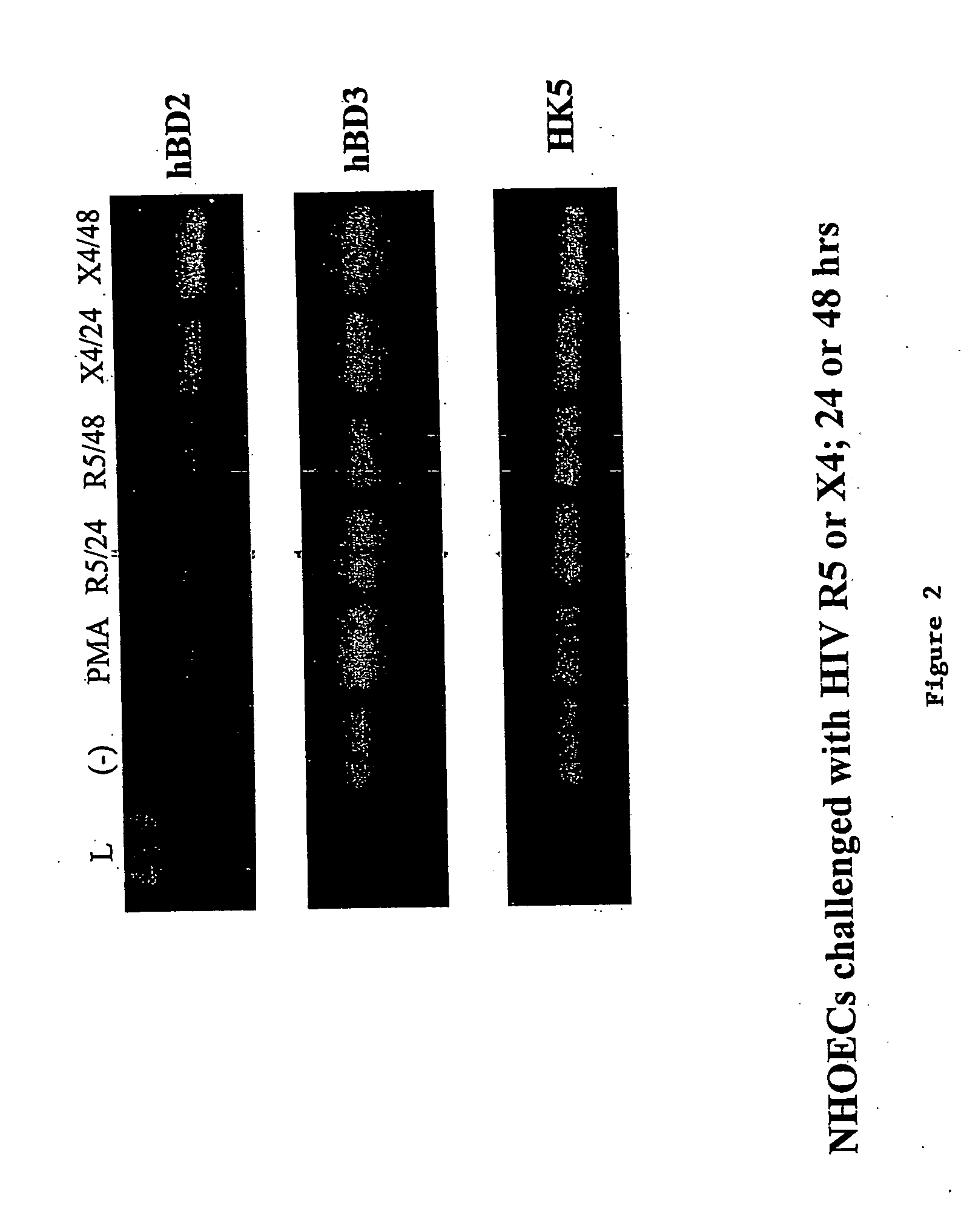 Compositions and methods of treating HIV infections