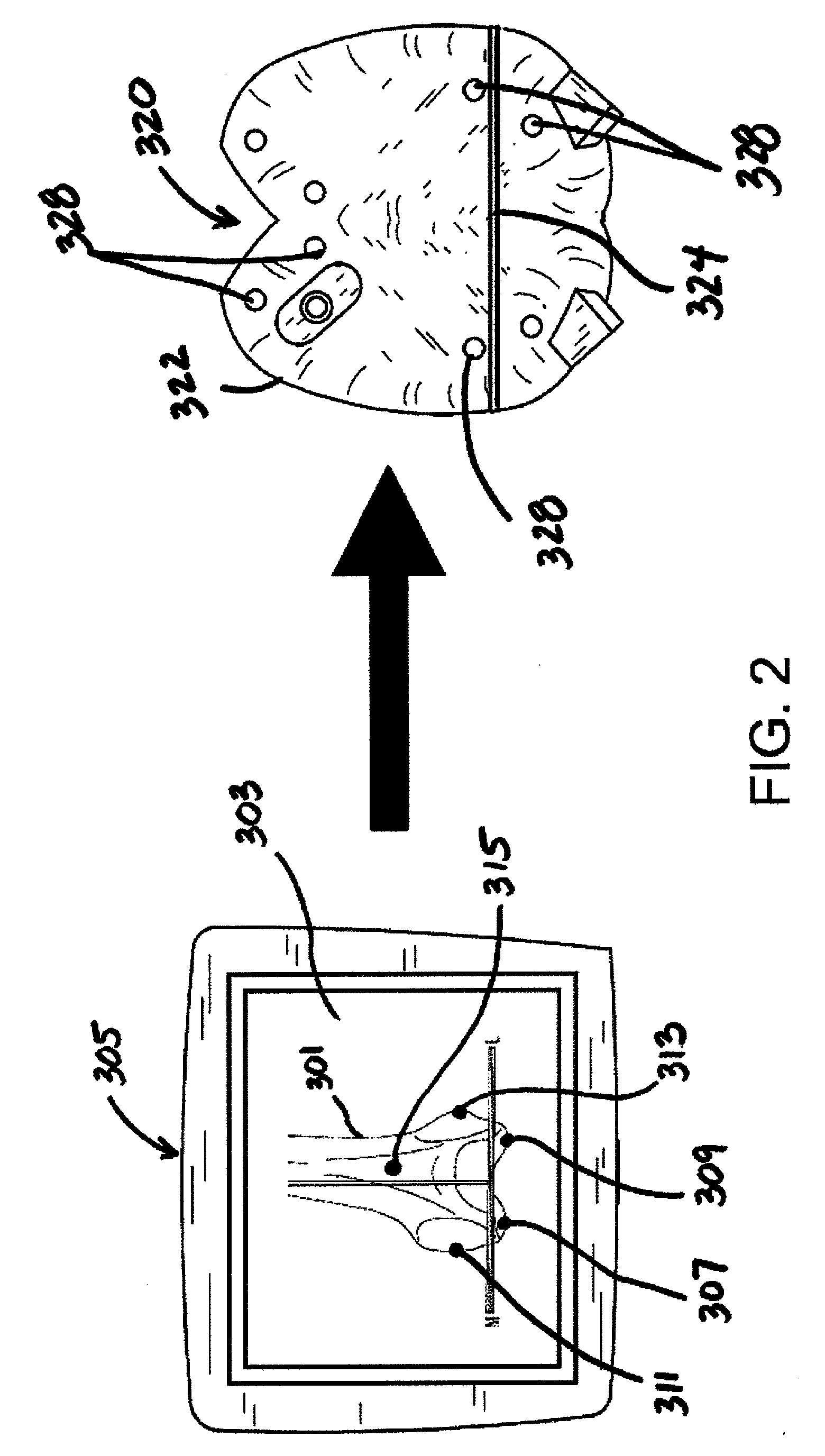 Patient-matched surgical component and methods of use