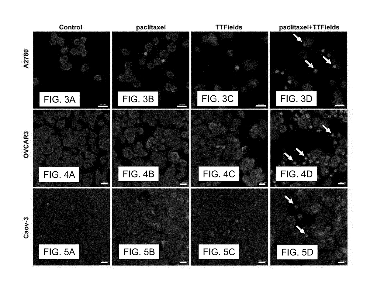 Synchronizing Tumor Cells to the G2/M Phase Using TTFields Combined with Taxane or Other Anti-Microtubule Agents