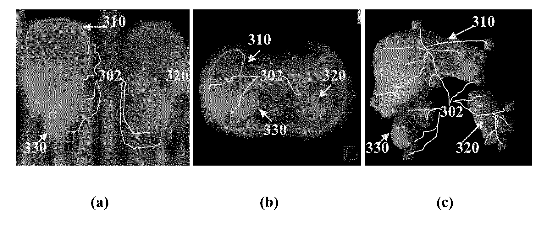 Method and System for Joint Multi-Organ Segmentation in Medical Image Data Using Local and Global Context
