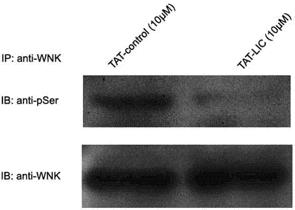 Recombined membrane-penetrating peptide with WNK (with no lysine (K)) kinase inhibiting effect