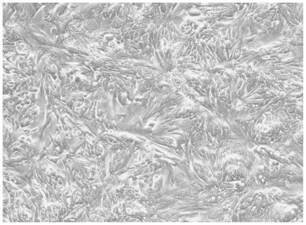 Human intestinal cancer primary cells, applications and culture methods