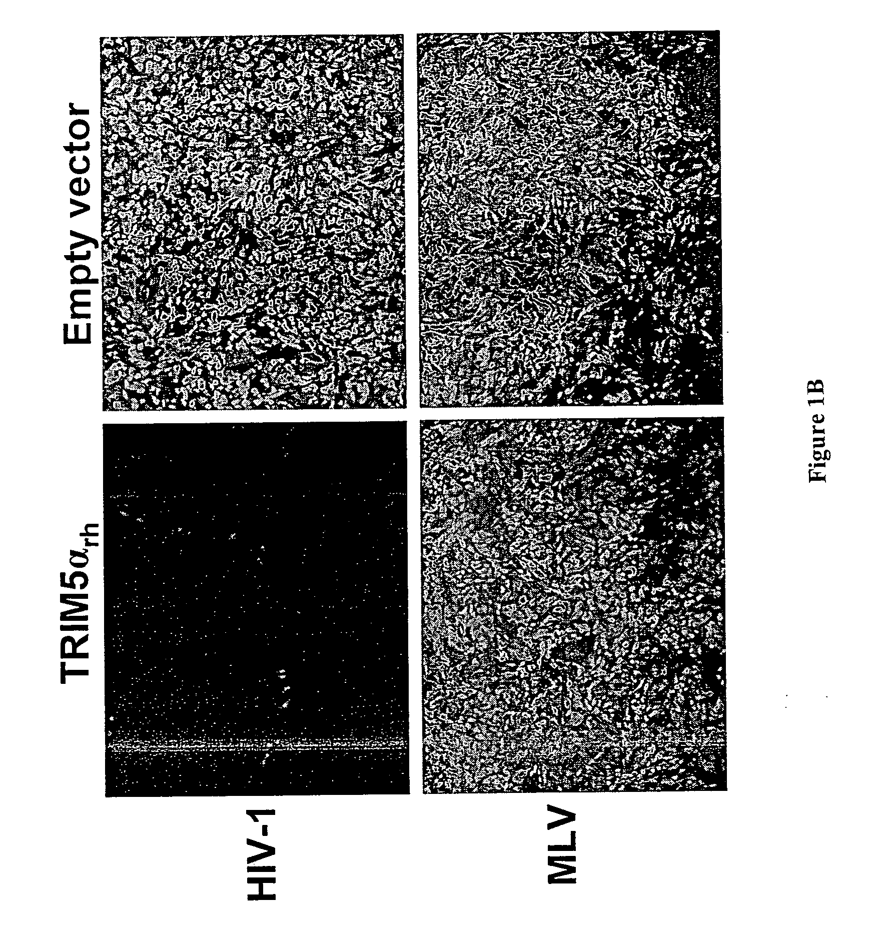 Methods and compositions for the treatment and prevention of HIV infection using TRIM5alpha